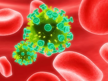 new hiv strain found in russia